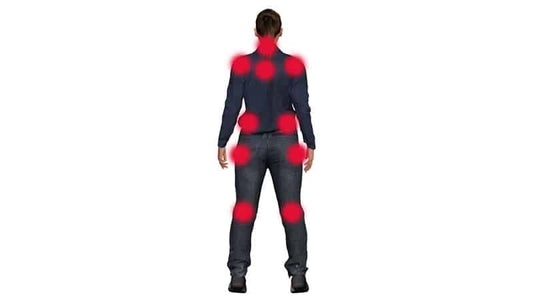 Fibromyalgia Explained