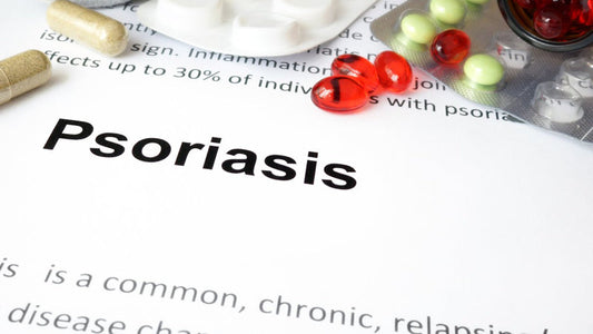 Psoriasis Risk Factors, Prevention and Tips