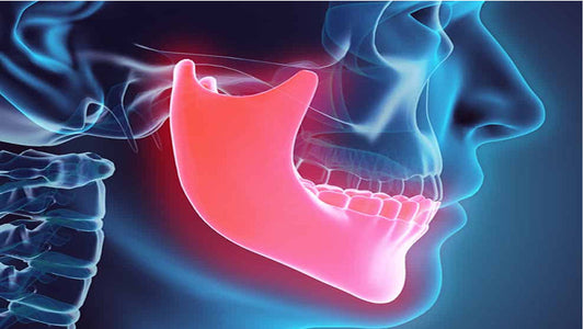 Root Canals: What You Need to Know